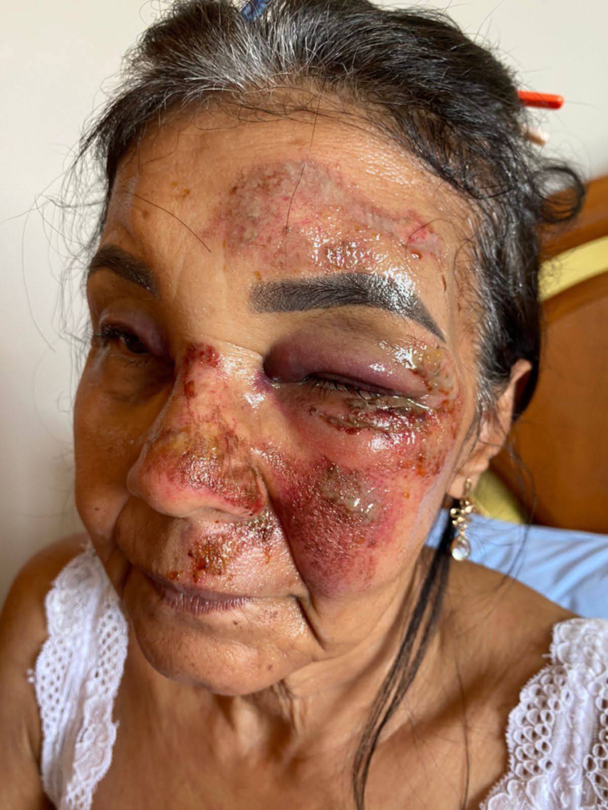 Homem é esfaqueado no Centro de Caparaó; autor é preso